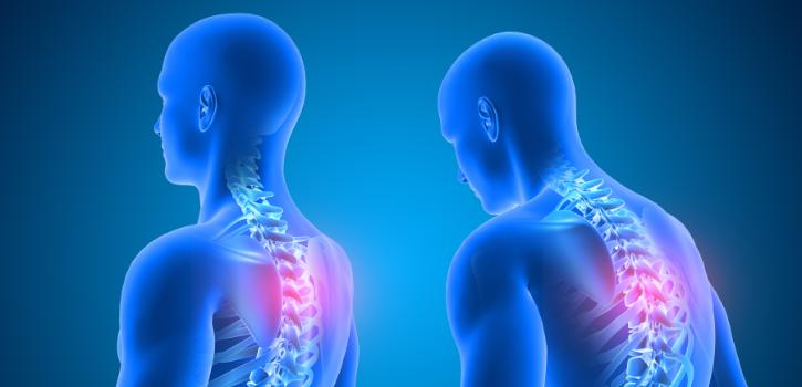 Higiene postural en el trabajo.